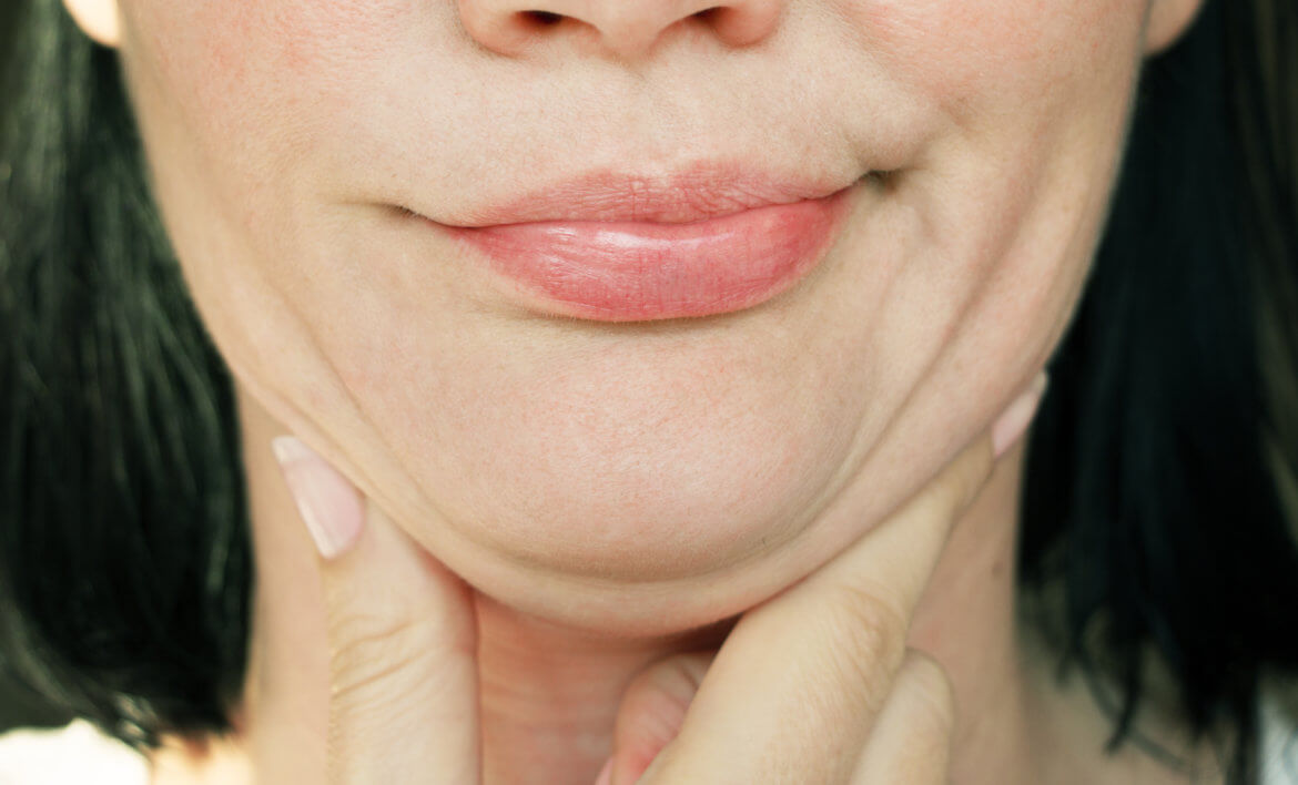 The Double Chin: Four Ways to Get Rid of That Stubborn Neck Area Fat Chin