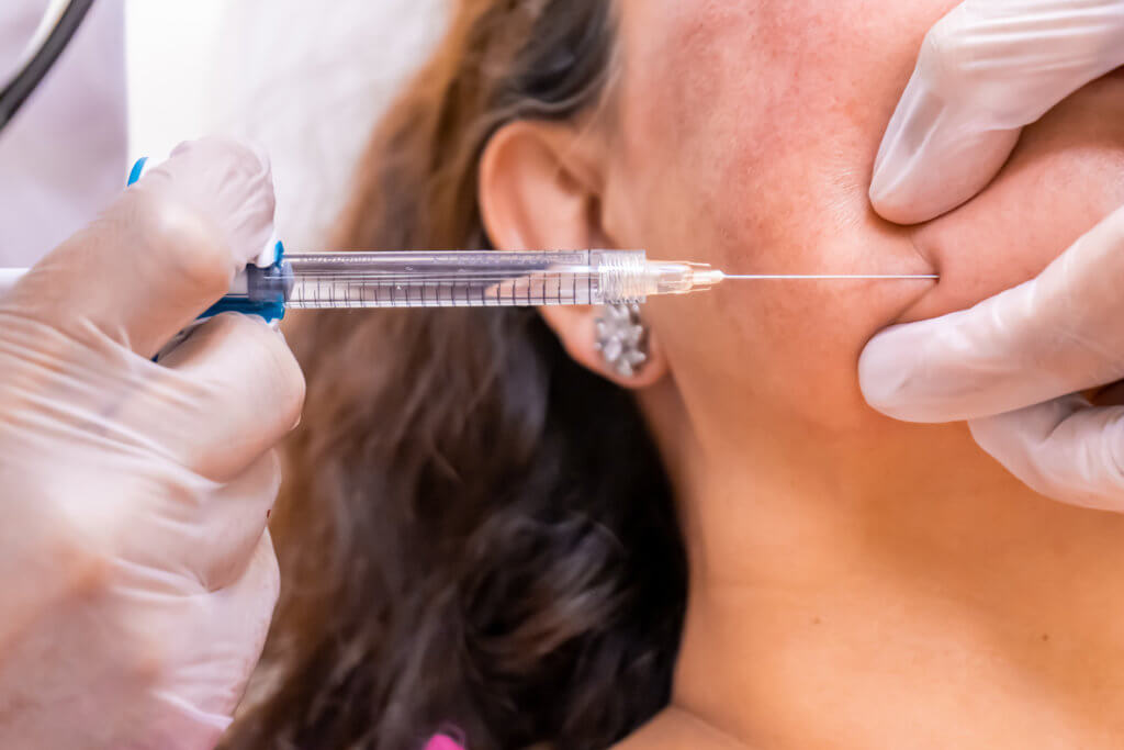 Investigating Juvederm: A Hyaluronic Acid Dermal Filler