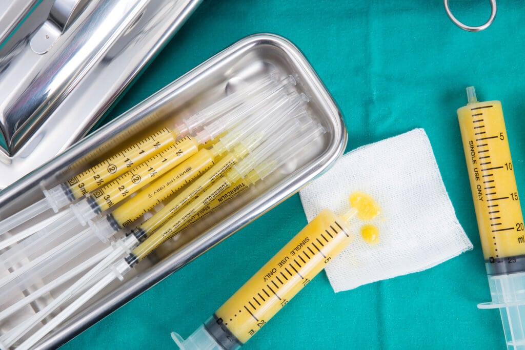 Fat Transfer Breast Augmentations: What You Should Know