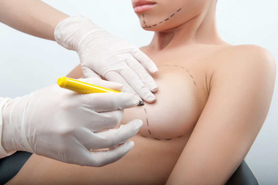 Fat Transfer Breast Augmentations: What You Should Know