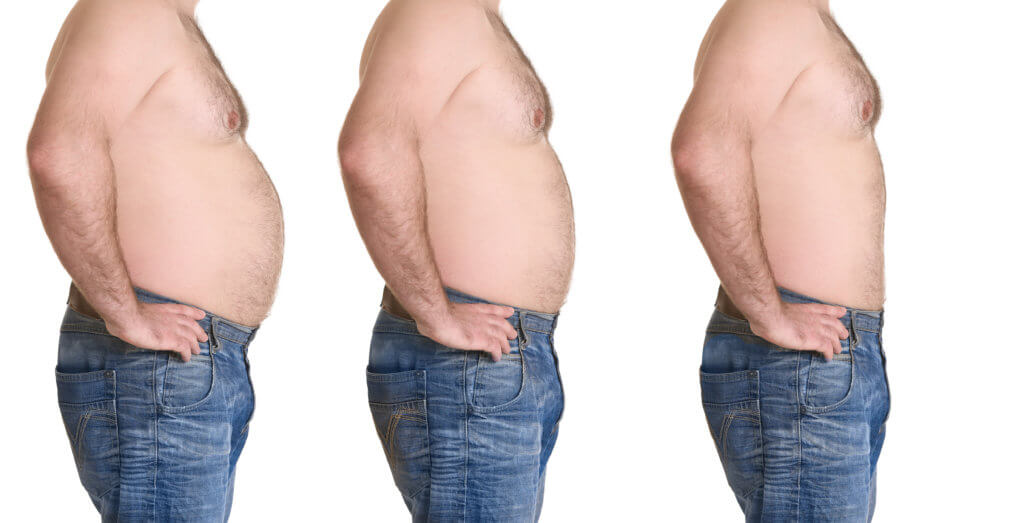 Noninvasive Body Contouring Procedures Designed For Men