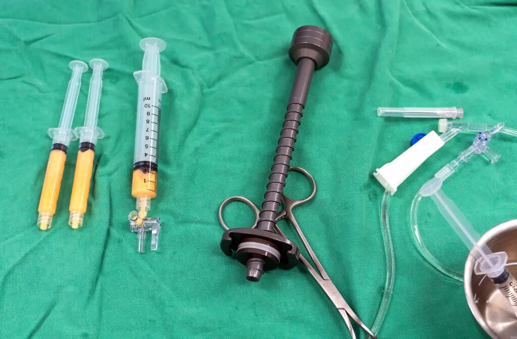Comparing Breast Enhancements: Autologous Fat Transfer Vs Implants